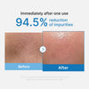 Zero Pore Blackhead Deep Cleansing Oil - medicube.us
