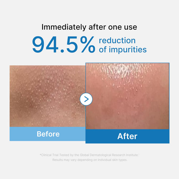 [Subscr.] Zero Pore Blackhead Deep Cleansing Oil alternate view