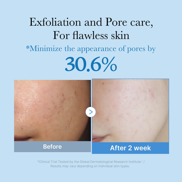 Zero Pore Toner alternate view