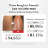 Hypochlorous Acid Rice Body Peel Shot - medicube.us