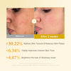 Kojic Acid Turmeric Toner - medicube.us