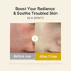 Kojic Acid Turmeric Vitamin Gold Jelly Mist Serum - medicube.us