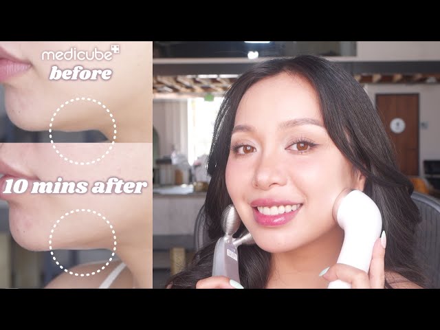 How To Get a Jawline and Reduce Double Chin With This